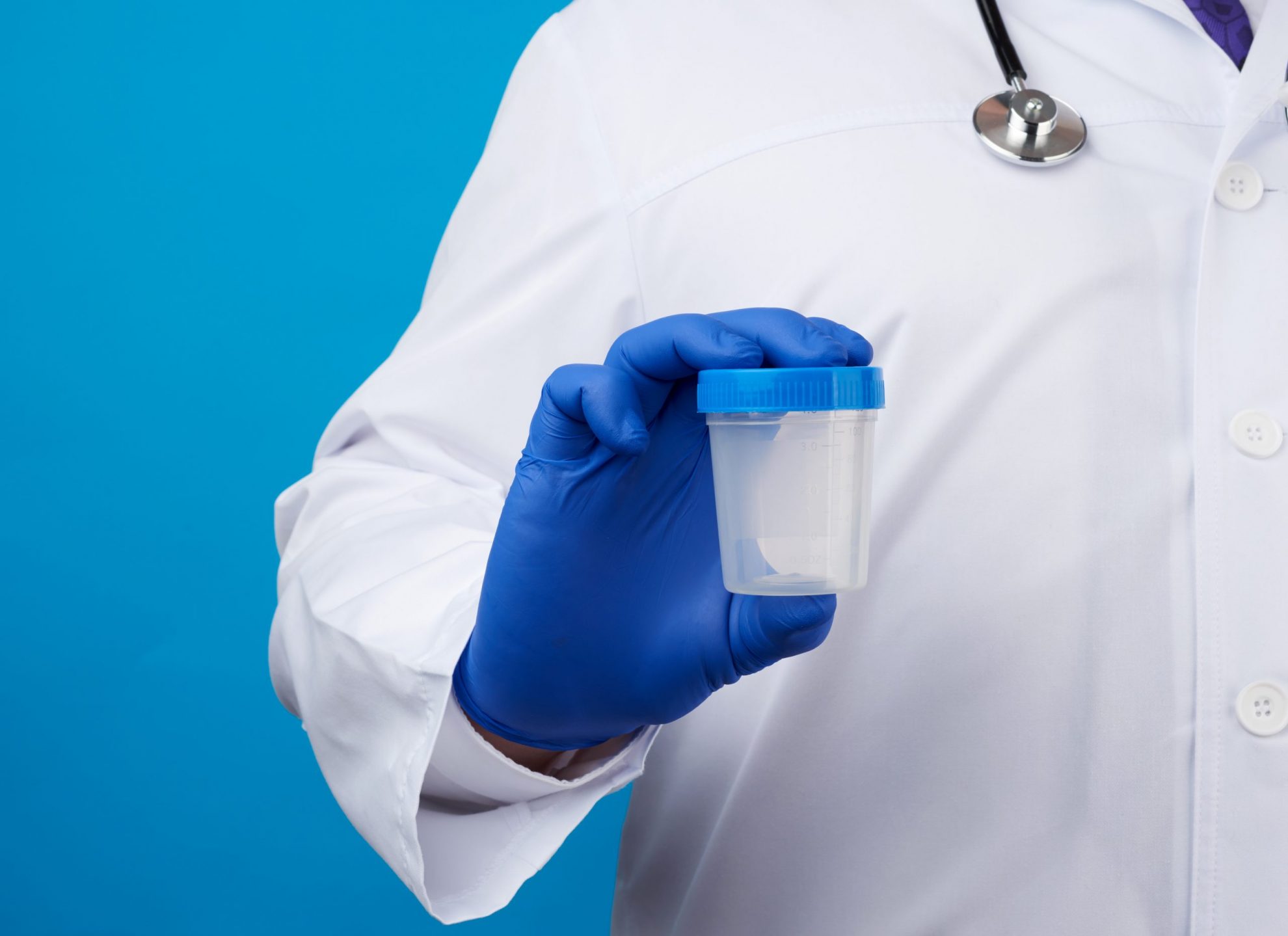 Photo of person in lab coat holding drug test cup.